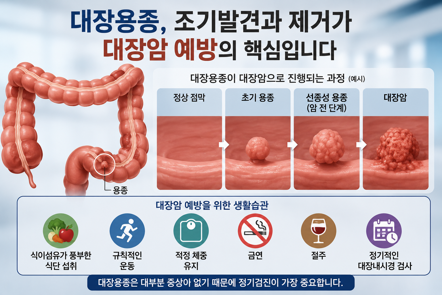 "대장용종은 암이 아닙니다." 하지만 그냥 두면 위험할 수도 있습니다.