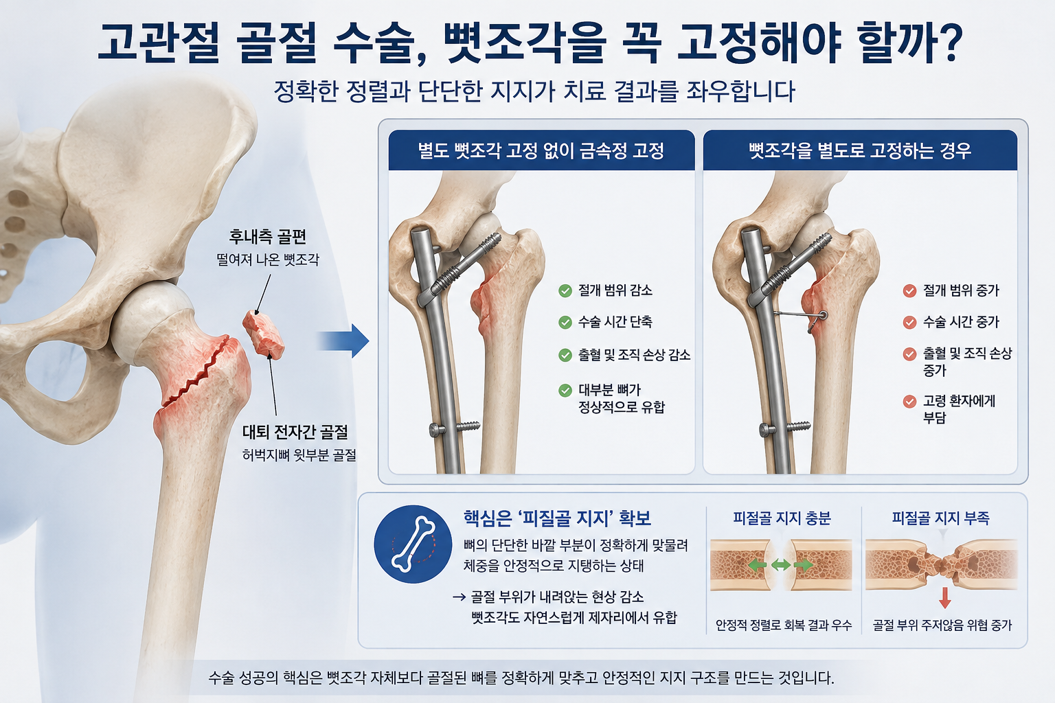 관절수술 중 고관절 수술에 대해