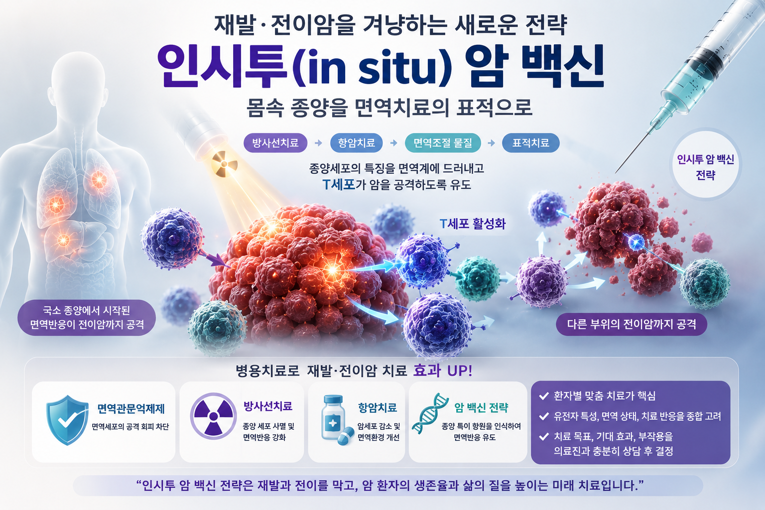 재발·전이암에 맞서는 ‘현장 암 백신’, 몸속 종양을 면역치료의 표적으로