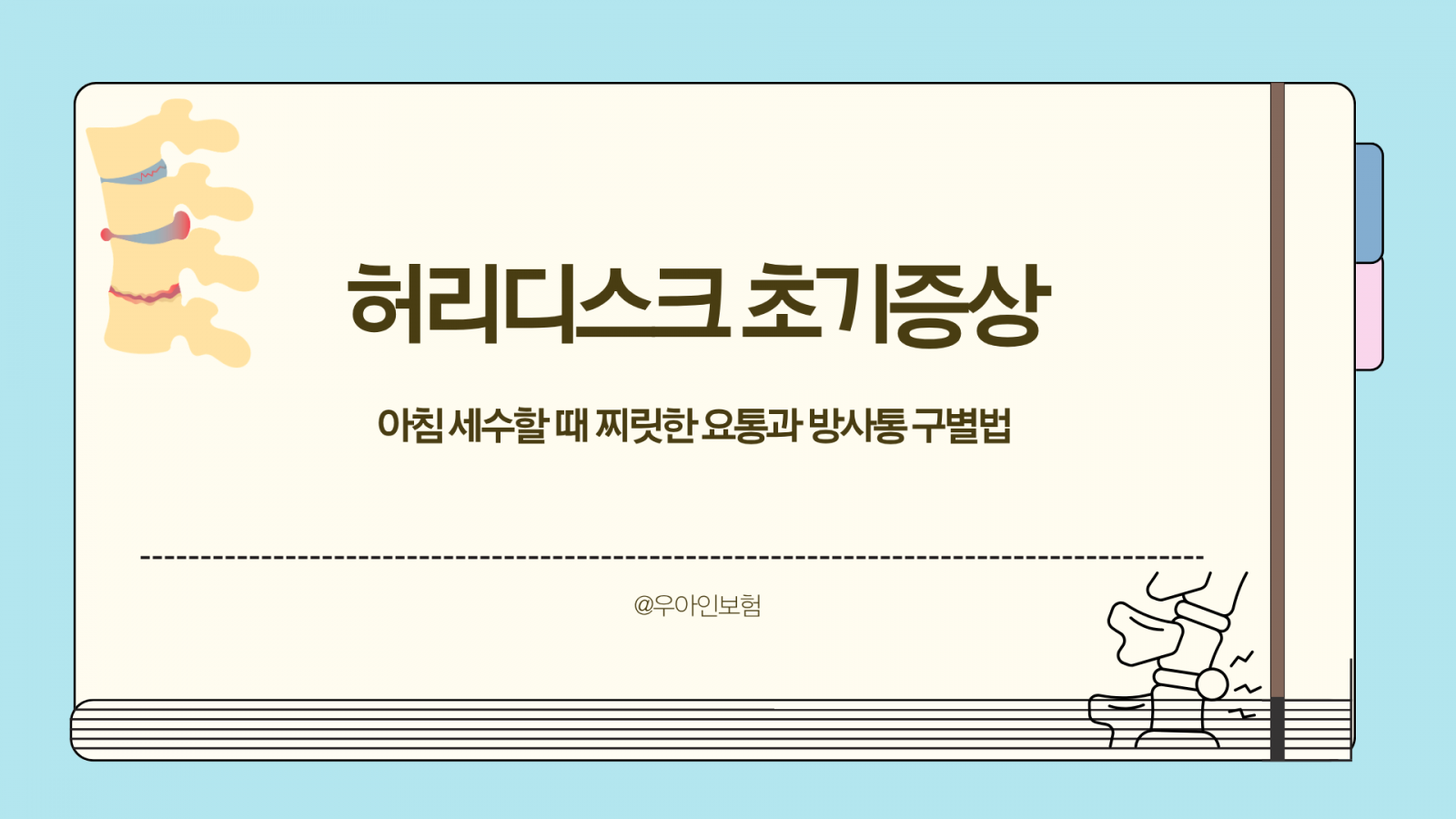 허리디스크 초기증상, 아침 세수할 때 찌릿한 요통과 방사통 구별법